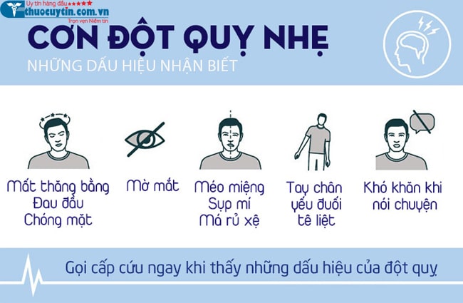 Dấu hiệu của cơn đột quỵ nhẹ