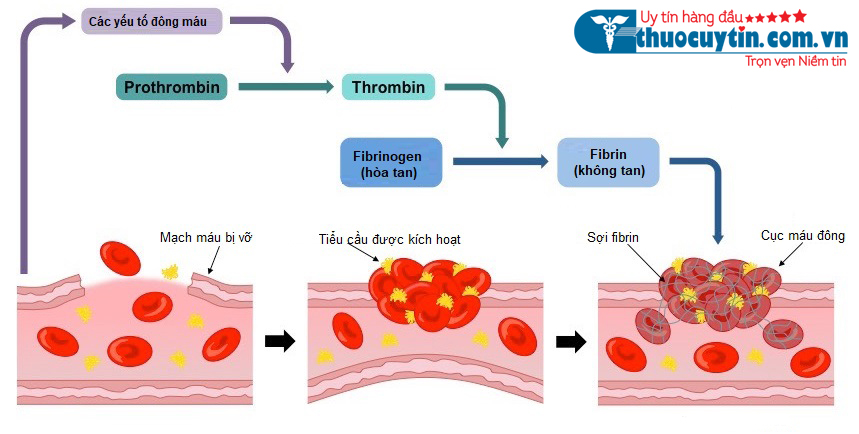 Nguyên nhân gây ra hội chứng Thrombophilia