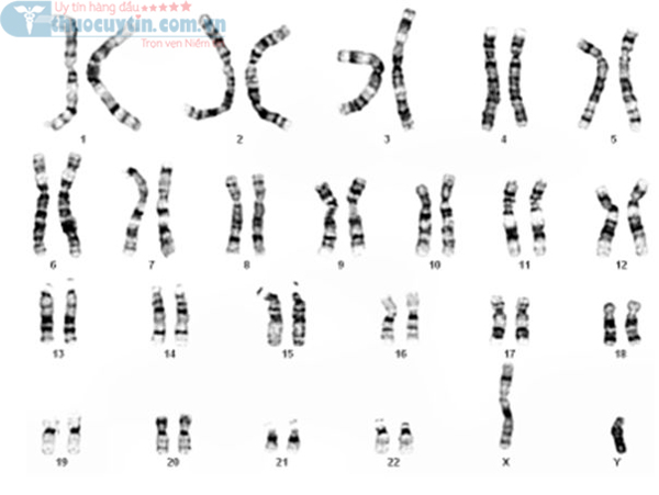 đột biến gen Thrombophilia do di truyền