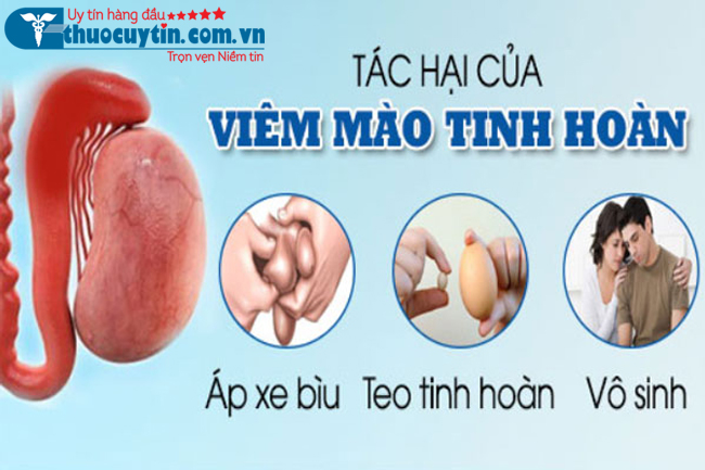 Cách điều trị viêm mào tinh hoàn