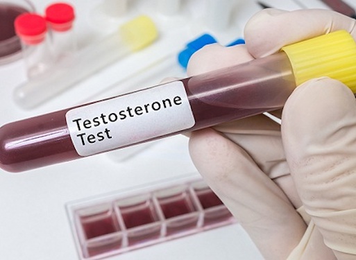 Khi nào nam giới cần kiểm tra nồng độ testosterone?