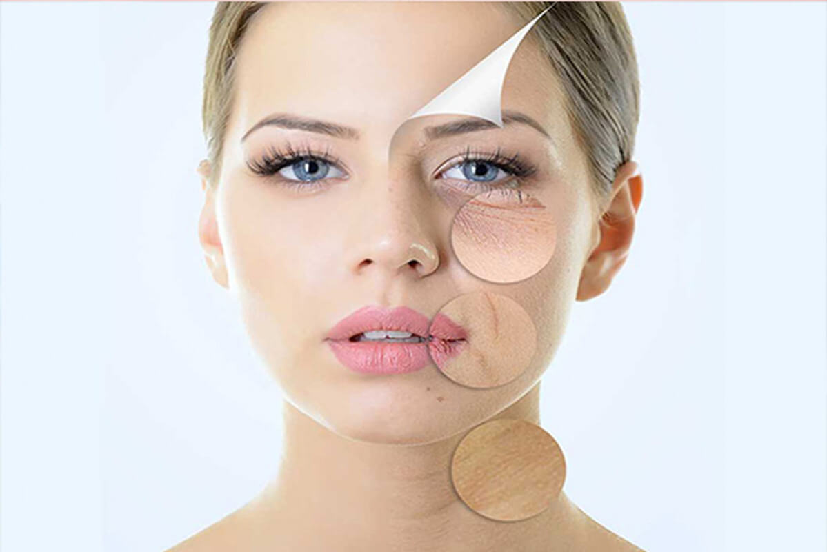 PRO JEL GIẢM NÁM, TÀN NHANG, NẾP NHĂN, CÂN BẰNG NỘI TIẾT