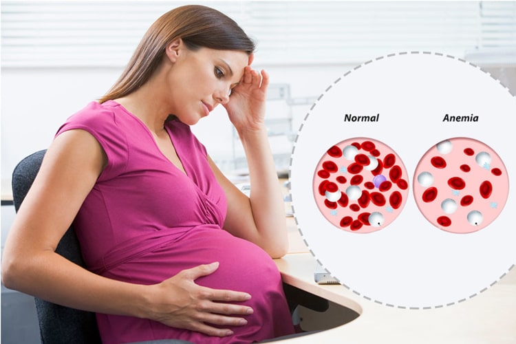 thiếu máu ở phụ nữ đang mang thai rất nguy hiểm